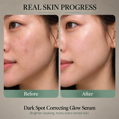 Axis Y- Dark Spot Correction Glow Serum 50ml