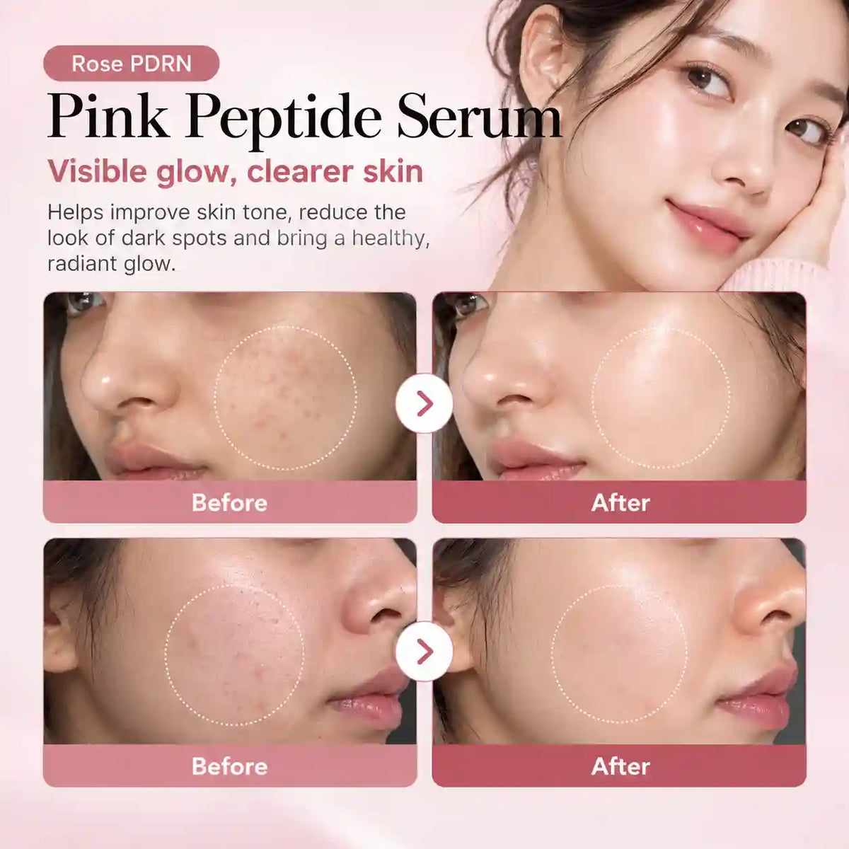 Medicube - PDRN Pink Peptide Serum 30ml